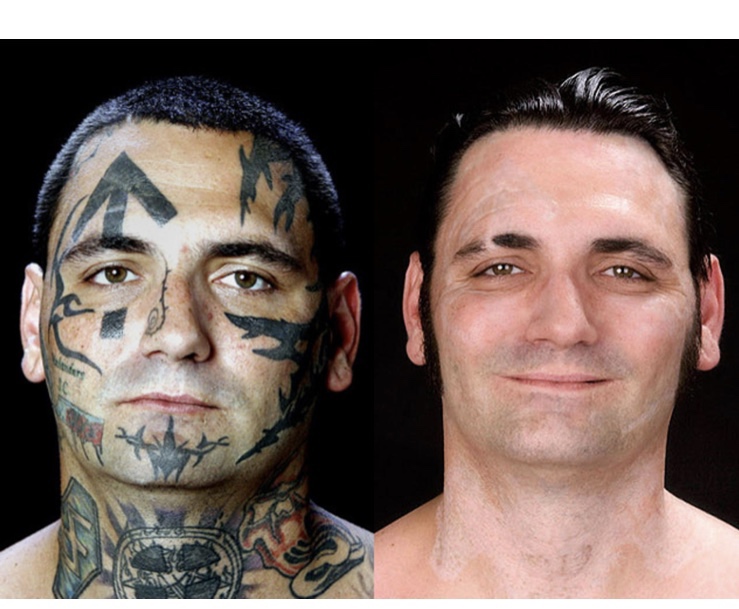 This (formerly) racist Nazi got his tattoos removed! They've made a feel-good movie called “Skin” based on his life. It’s about redemption and change.