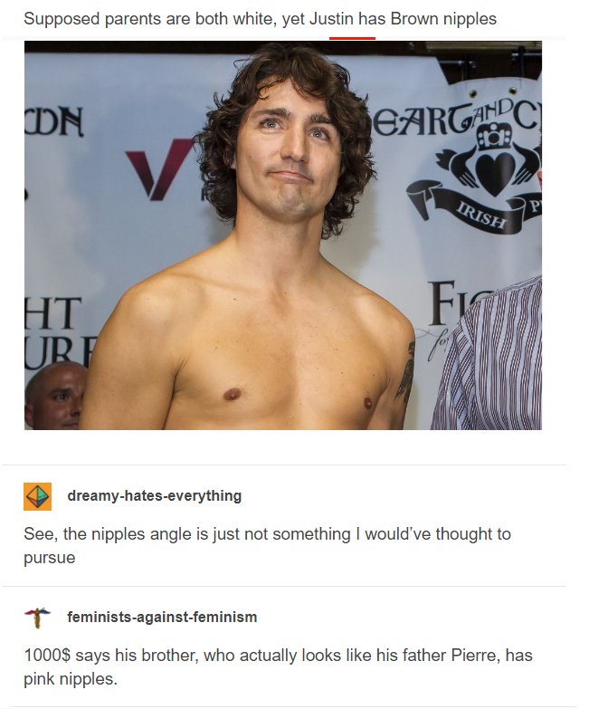Supposed parents are both white, yet Justin has Brown nipples See, the nipples angle is just not something I would've thought to pursue feministsagainstfeminism 1000$ says his brother,