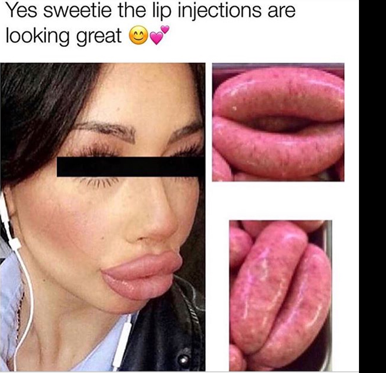 lip injections meme - Yes sweetie the lip injections are looking great