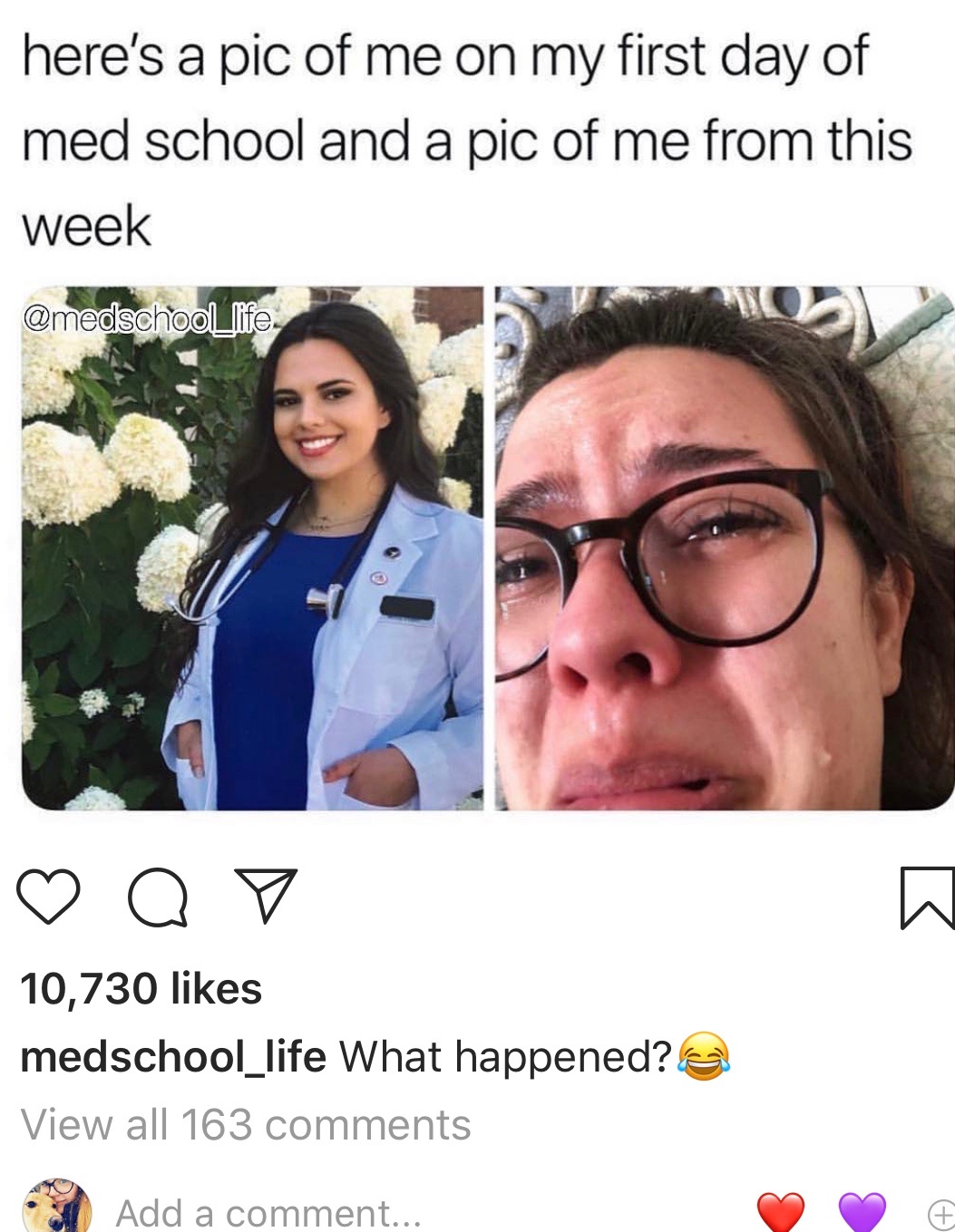 medical school memes - here's a pic of me on my first day of med school and a pic of me from this week o 10,730 medschool_life What happened? View all 163 Add a comment...