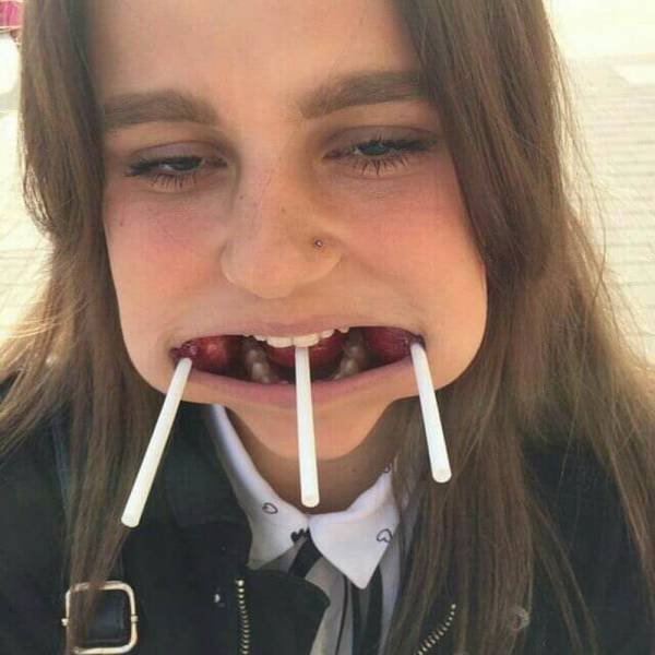 girl with three lolly pops in her mouth