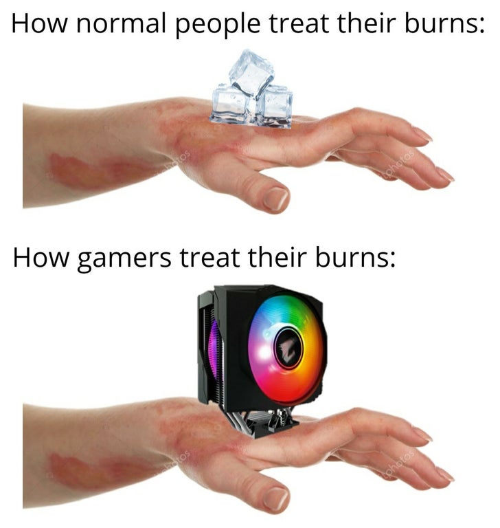 funny gaming memes - hand - How normal people treat their burns tos tohotos How gamers treat their burns wastos photos