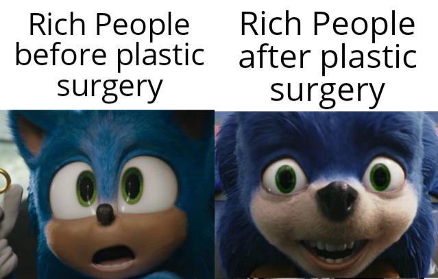 gaming dank memes - ugly sonic - Rich People before plastic surgery Rich People after plastic surgery