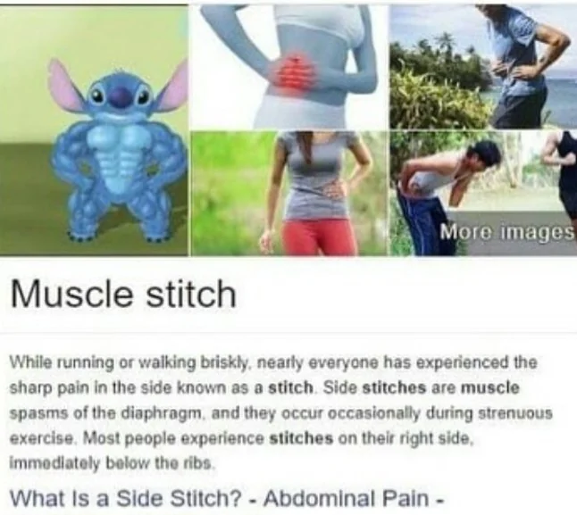 funny memes pics and tweets - play - More images Muscle stitch While running or walking briskly, nearly everyone has experienced the sharp pain in the side known as a stitch. Side stitches are muscle spasms of the diaphragm, and they occur occasionally du