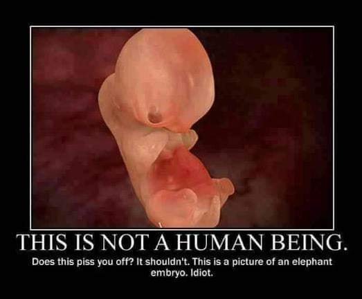 fetus is not a human being - This Is Not A Human Being. Does this piss you off? It shouldn't. This is a picture of an elephant embryo. Idiot.