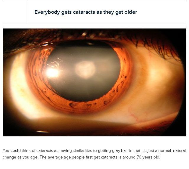25 Interesting Facts About The eye