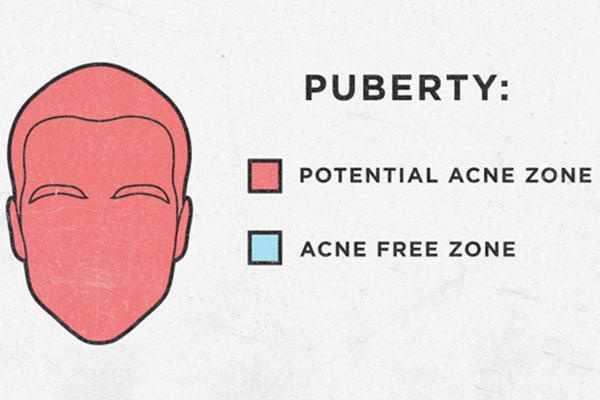 girl code illustrations - Puberty Potential Acne Zone Acne Free Zone