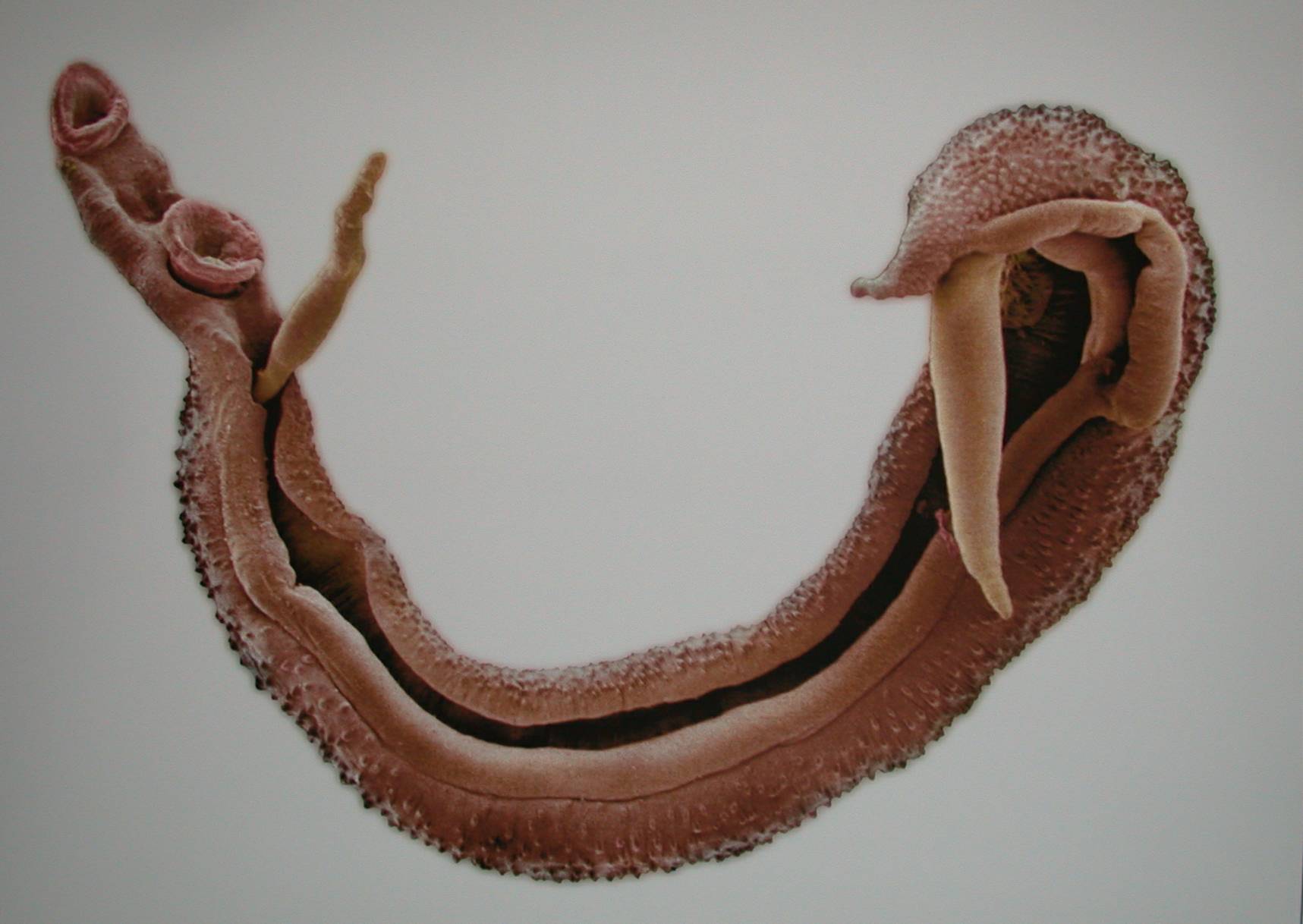The schistosomiasis worm is a dangerous parasite that can increase the risk of HIV/AIDS infection. Researchers believe this common worm may be responsible for the high rates of HIV infections in women in Africa because of the worm’s behavior in the female body. When women do laundry in the waterways, the worm makes it way up the vaginal canal and creates small sores inside, which open the way for HIV infection.
