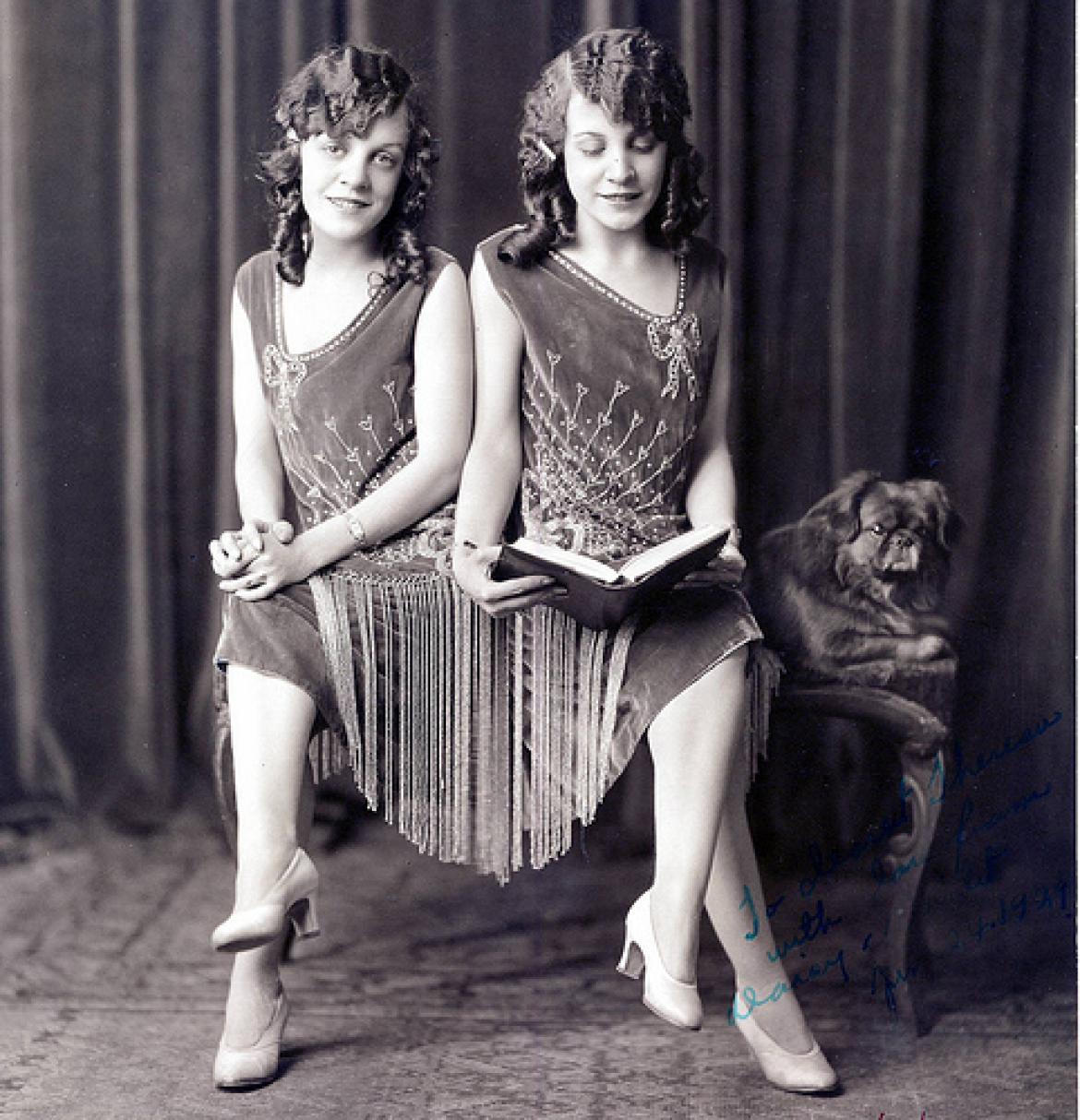 Conjoined Twins, Daisy and Violet Hilton, Late 1920s.