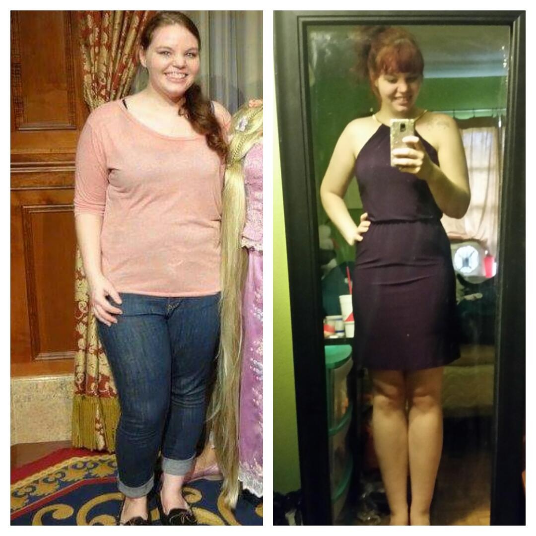 20 More Stunning Weight Loss Transformations
