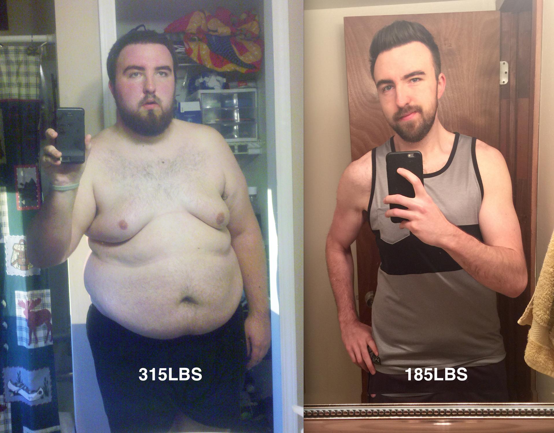 20 More Stunning Weight Loss Transformations Gallery