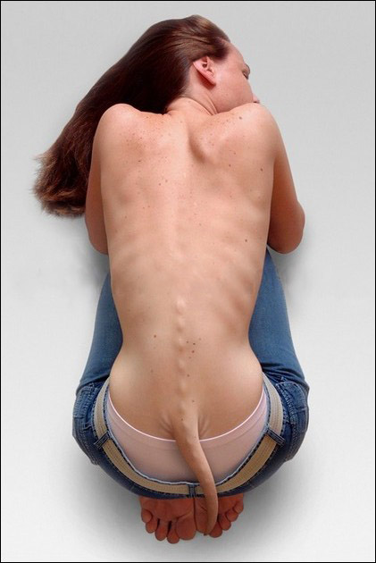 Vestigial tail - when a child is born with a semi-functional tail, with 

muscles, nerves, skin, and blood vessels.