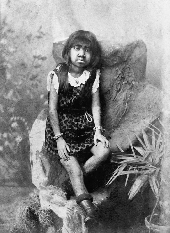Krao, often referred to as The Missing Link, was a freak show performer 

ever since she was a small child. She later reached a kind of celebrity 

status among freaks and displayed herself to the audience on her own 

terms, without the need of a promoter.