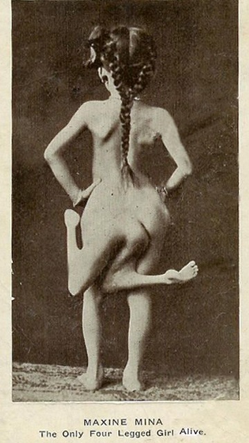 Maxine Mina from Phillipines had two sets of limbs, which she could 

control. Known as The Four Legged Girl, she would perform naked, to 

show off her deformity to the fullest.