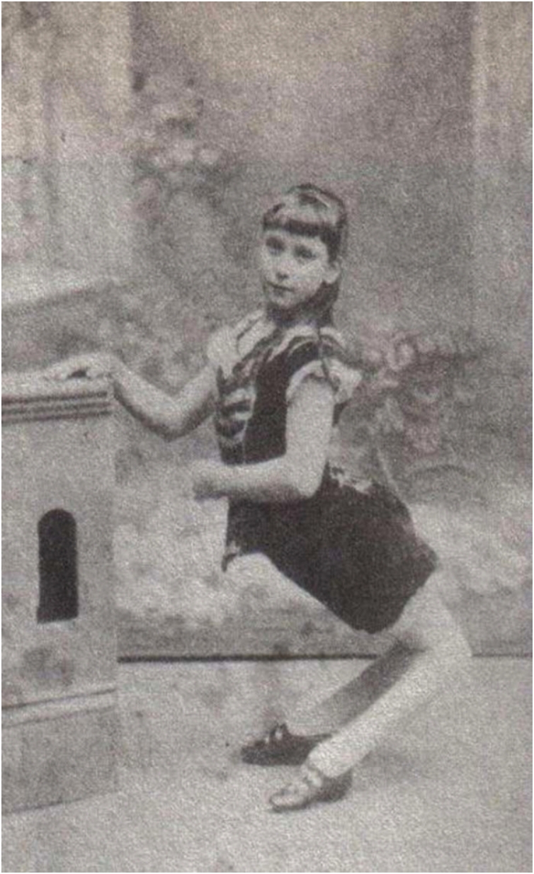 Ella Harper was one of the highest-earning freak show attractions in 

history. Suffering from back knees deformity, she was a crowd magnet.