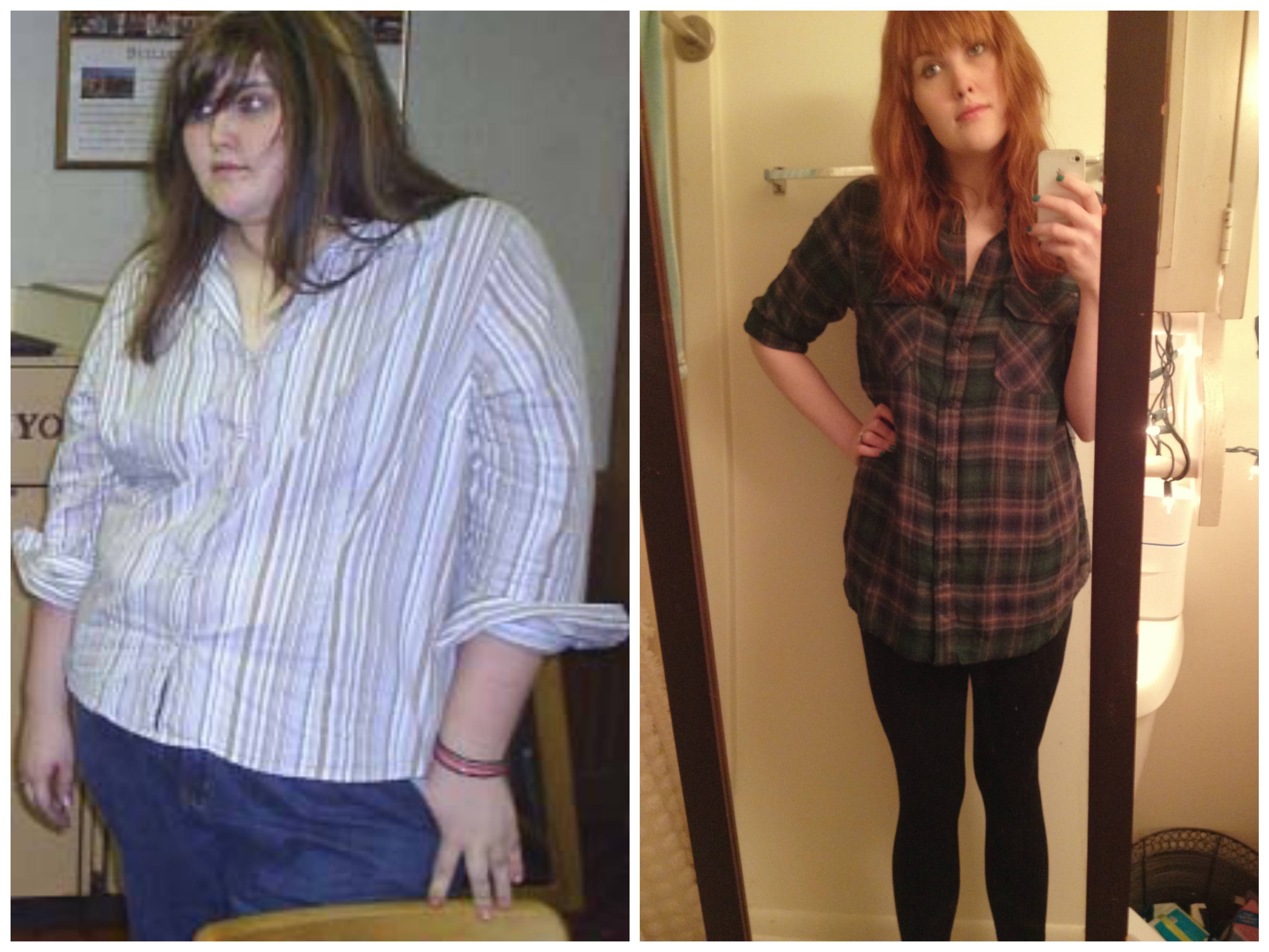 before and after weight loss reddit