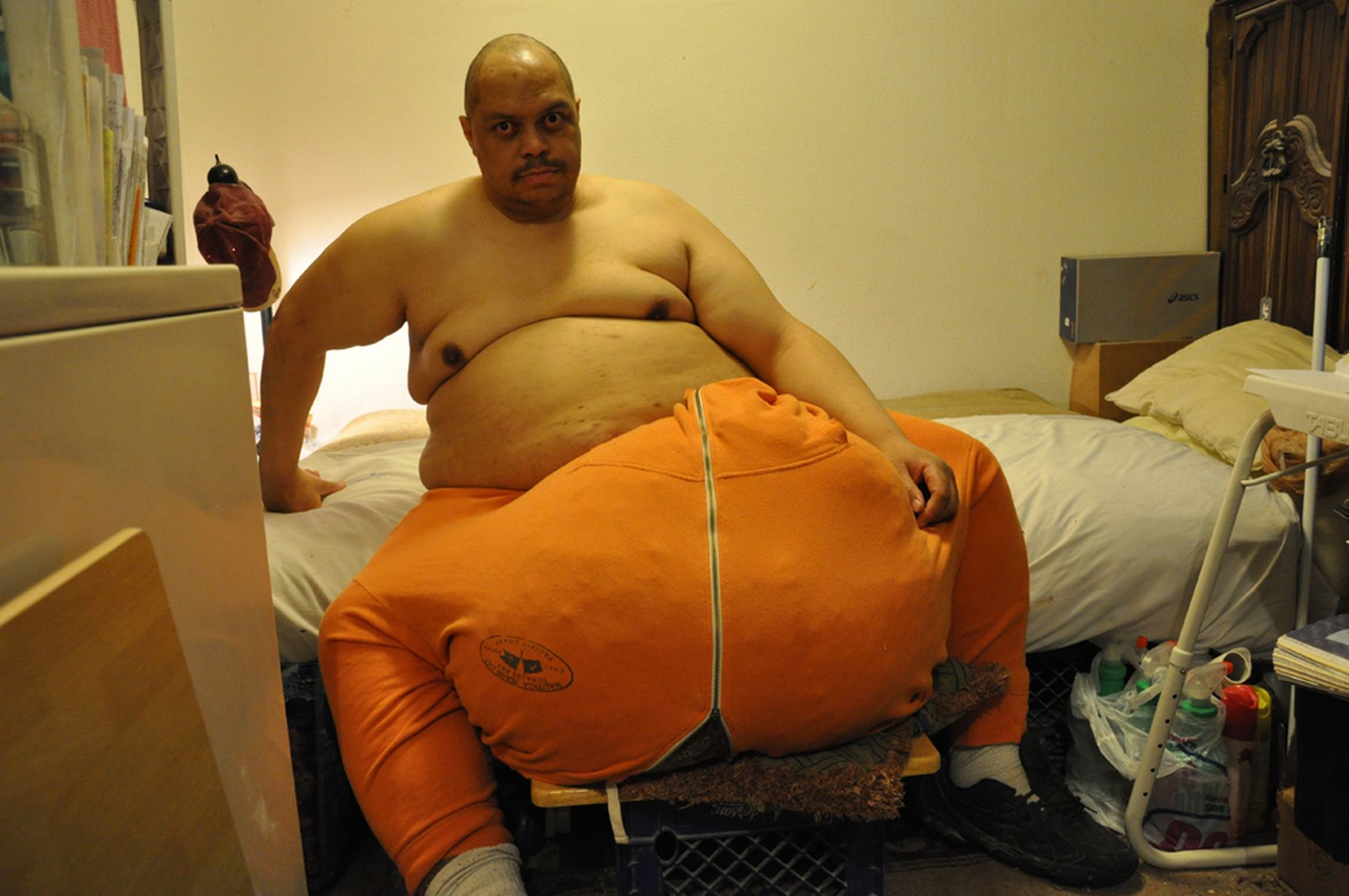 Wesley Warren Jr. brought attention to himself trying to raise the $1 

million necessary for surgery to have his 160 pound scrotum removed. 

In April 2013, a doctor offered to perform the surgery free of 

charge.