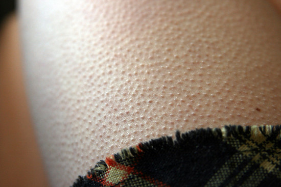 Goosebumps are the result of flexing muscles at the base of each hair follicle. There are two reasons humans get goosebumps. The first happens when someone is cold. The second is when you're scared and works much like a cat's fur when it feel threatened -  By raising the hair when we’re ready to fight it made us appear bigger. Okay, it would, if we had fur.