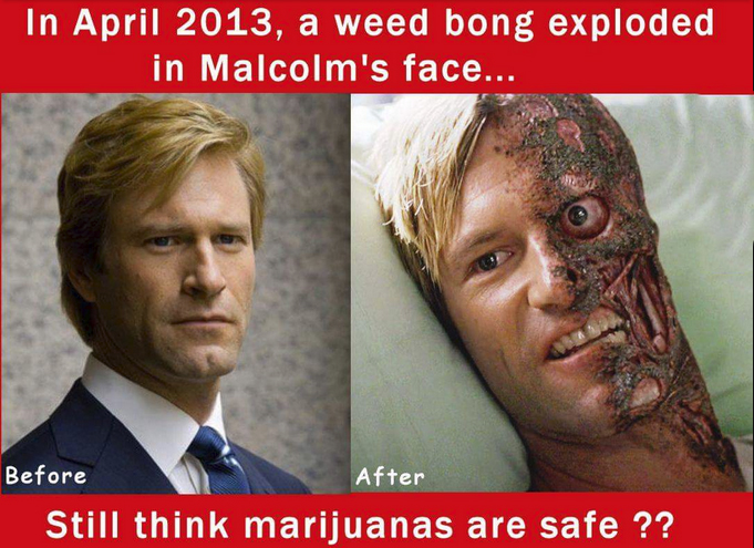 believe in harvey dent - In , a weed bong exploded in Malcolm's face... Before After Still think marijuanas are safe ??