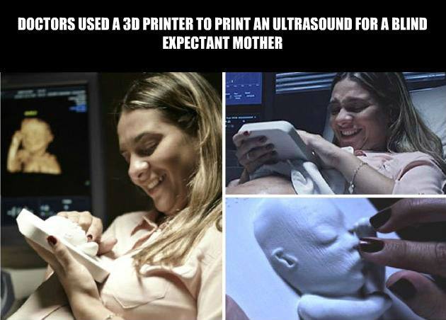 3D printing - Doctors Used A 3D Printer To Print An Ultrasound For A Blind Expectant Mother