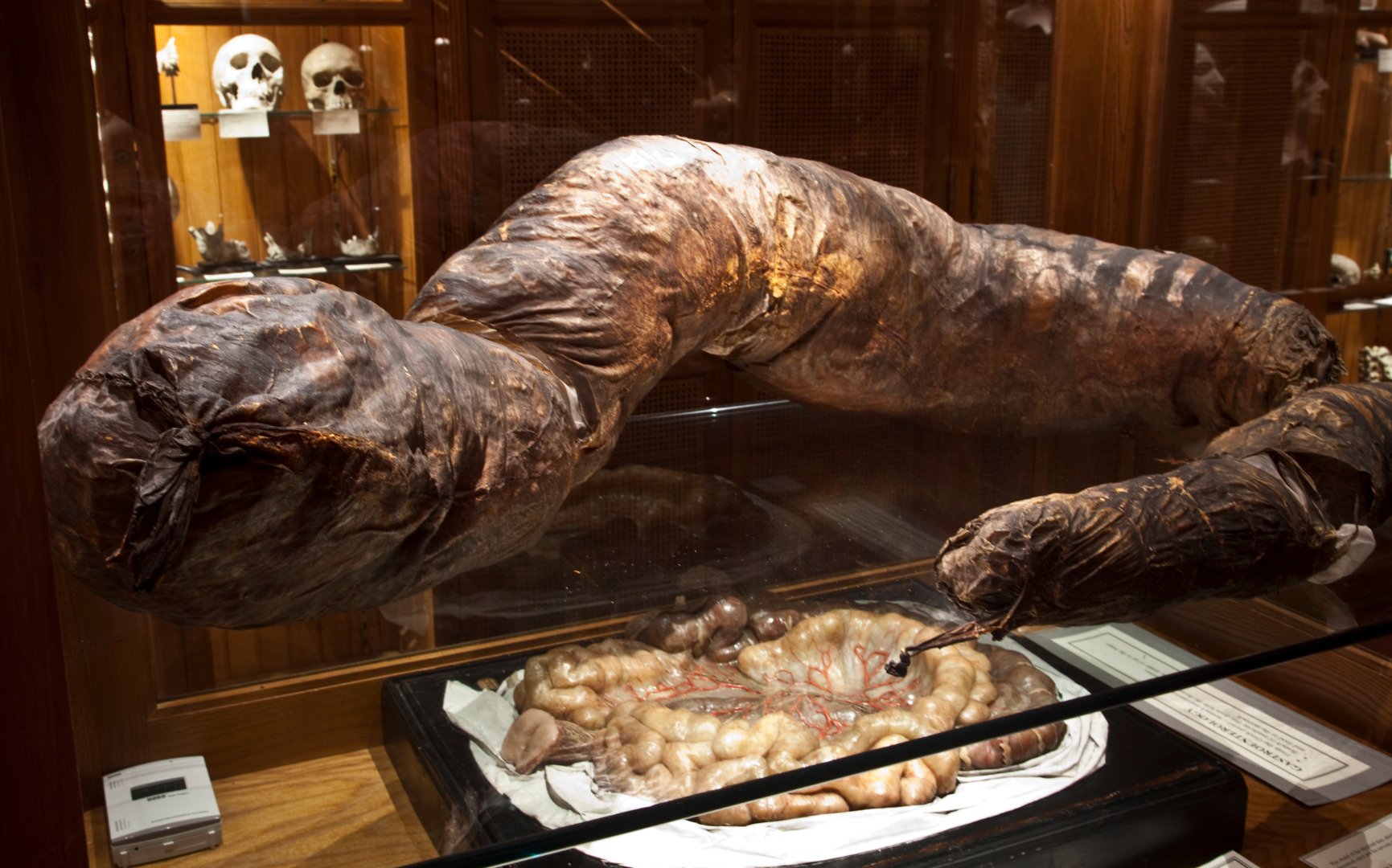 The Mutter Museum holds a collection of medical oddities and unusual specimens.