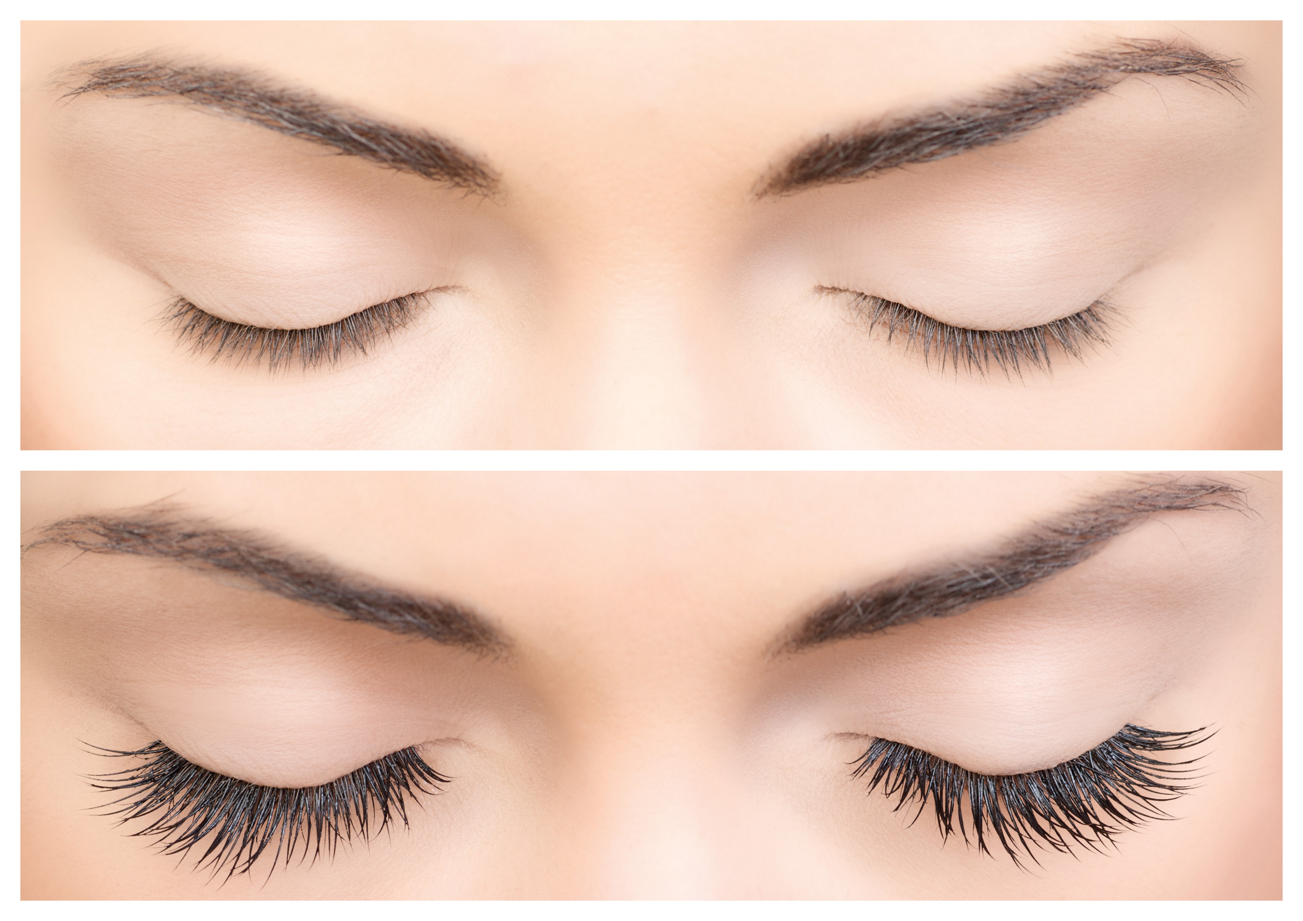 The eyelash transplant is slowly becoming a more and more popular of a proc...