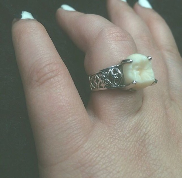 "I literally have my husband’s wisdom on my finger."