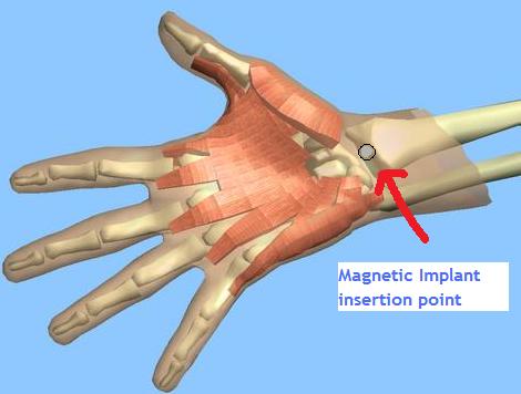 A small magnet implanted in a human hand can allow one to sense magnetic fields. This body mod can be very useful in professions that work with electric currents, allowing the detection of live wires and avoiding electric shock.