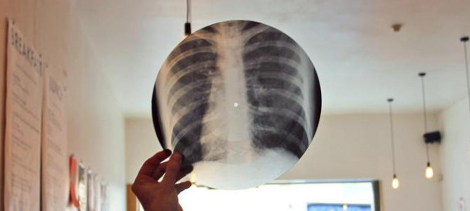 In Soviet Russia, people bootlegged forbidden Western music, but due 

to vinyl being in short supply, they would often use old x-rays, 

creating eerie-looking, hand-crafted records.