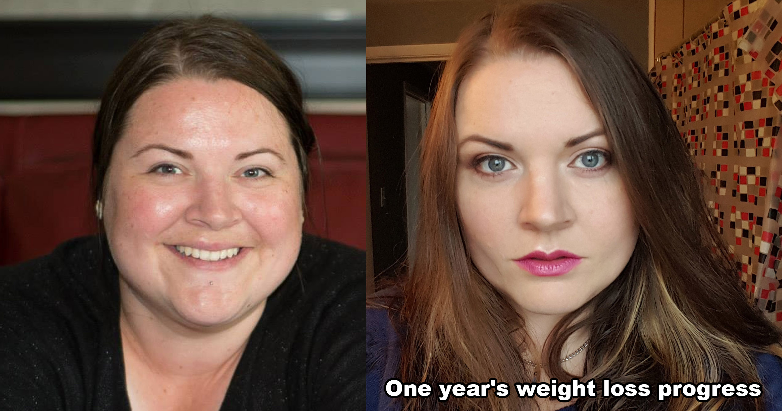 weight loss eyes - One year's weight loss progress