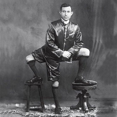He would conduct interviews while propped up on his extra limb, using it as a stool. He fielded questions ranging from his innocent hobbies to the particulars of his sex life. He was also often asked about his shoes. People wondered if it was difficult to buy shoes in a set of three. Showing his mental sharpness, he always revealed that he bought two pairs and gave the extra one to a one-legged friend.