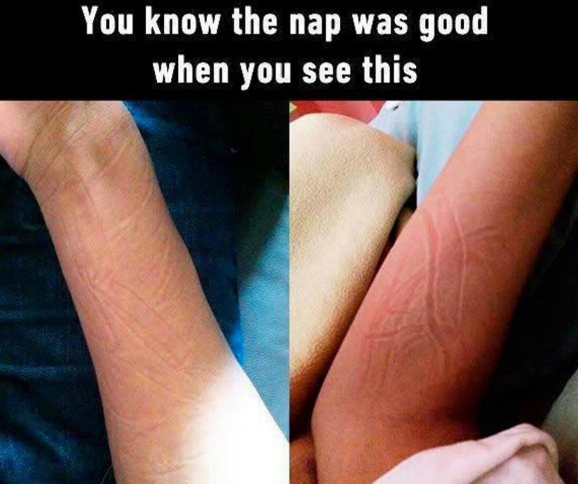 nail - You know the nap was good when you see this