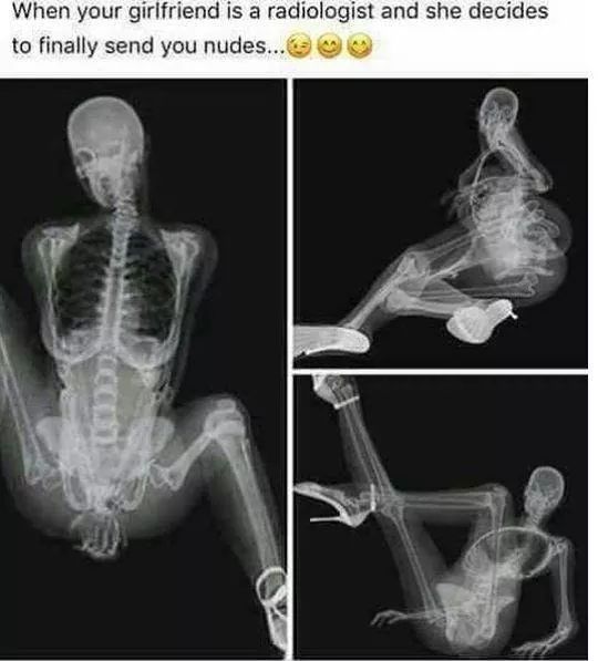 funny radiology - When your girlfriend is a radiologist and she decides to finally send you nudes...