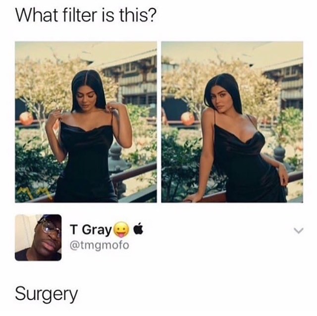 kendall and kylie drop 3 - What filter is this? T Gray Surgery