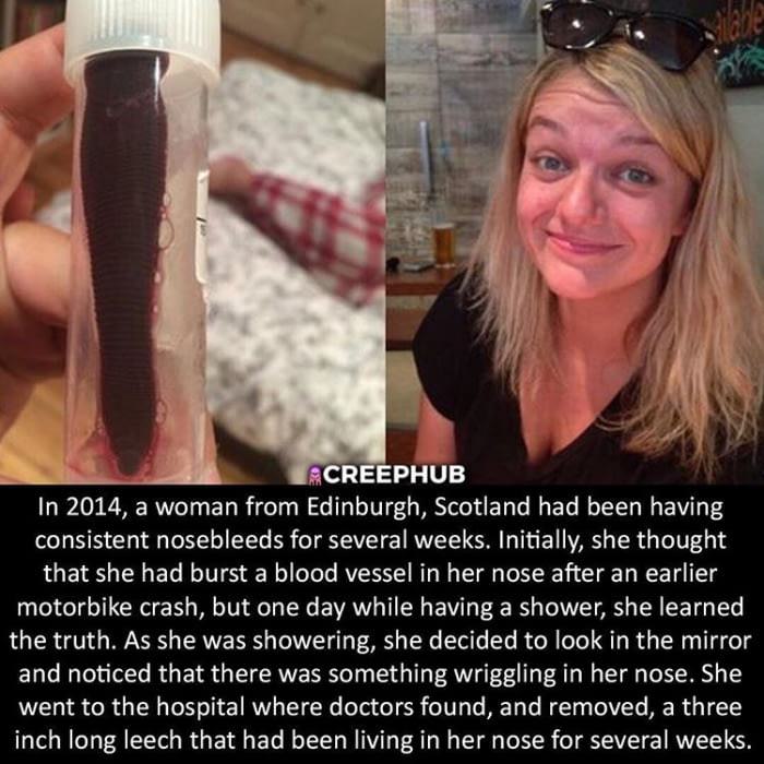 nosebleed kid meme - Creephub In 2014, a woman from Edinburgh, Scotland had been having consistent nosebleeds for several weeks. Initially, she thought that she had burst a blood vessel in her nose after an earlier motorbike crash, but one day while havin