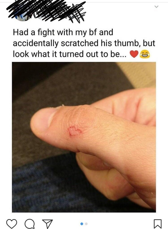 cringe mood cringe - Had a fight with my bf and accidentally scratched his thumb, but look what it turned out to be...