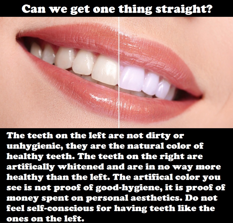memes - color are healthy teeth - Can we get one thing straight? The teeth on the left are not dirty or unhygienic, they are the natural color of healthy teeth. The teeth on the right are artifically whitened and are in no way more healthy than the left. 