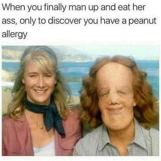 eat ass peanut allergy - When you finally man up and eat her ass, only to discover you have a peanut allergy