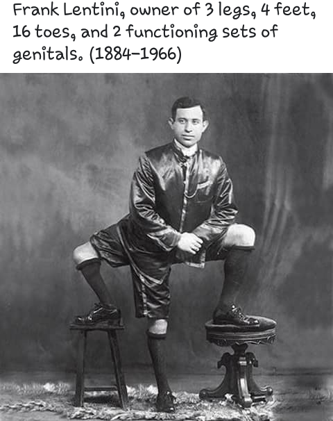 someone asks me who the hell i think - Frank Lentini, owner of 3 legs, 4 feet, 16 toes, and 2 functioning sets of genitals. 18841966