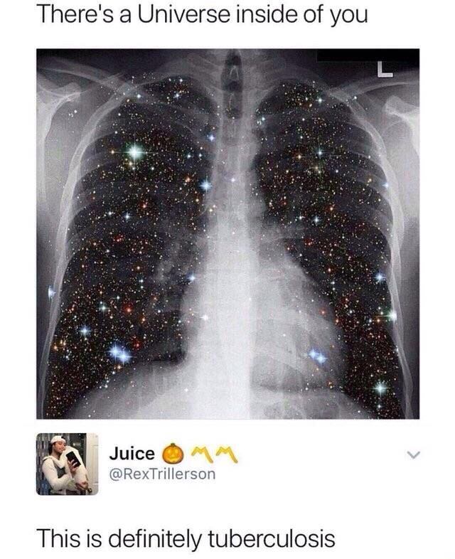 tuberculosis memes - There's a Universe inside of you Juice O Mm This is definitely tuberculosis