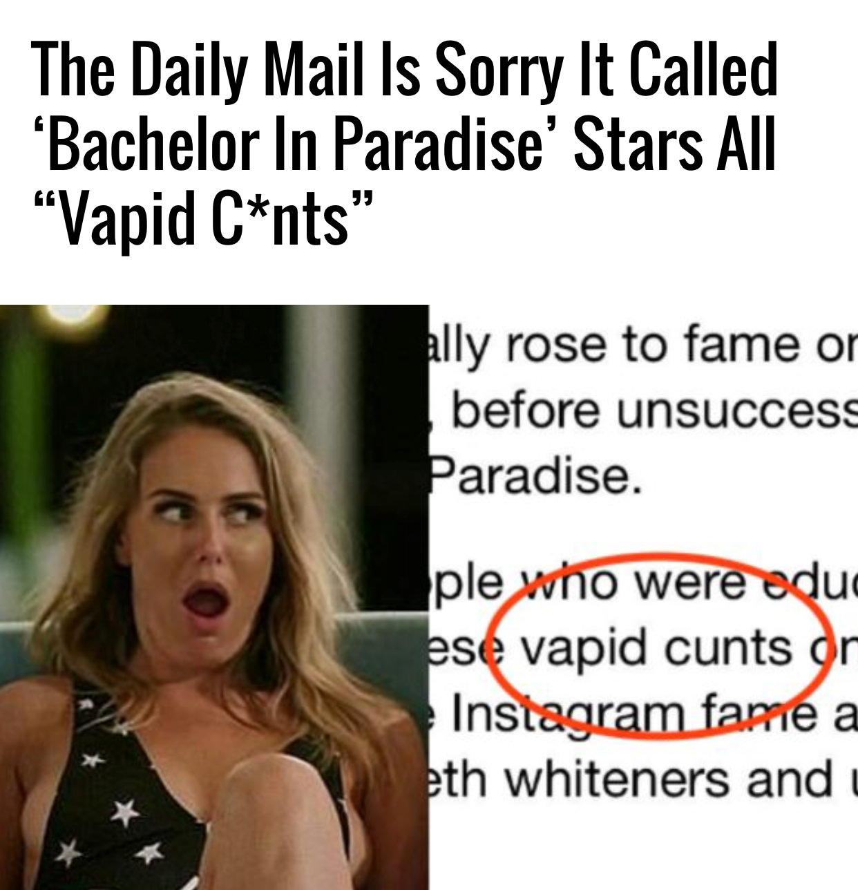photo caption - The Daily Mail Is Sorry It Called 'Bachelor In Paradise' Stars All "Vapid Cnts" ally rose to fame or before unsuccess Paradise. ple who were aduc ese vapid cunts or Instagram fame a ath whiteners and