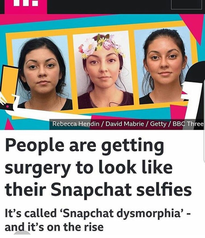 snapchat dysmorphia surgery before and after - Rebecca Hendin David Mabrie Getty Bbc Three People are getting surgery to look their Snapchat selfies It's called Snapchat dysmorphia' and it's on the rise