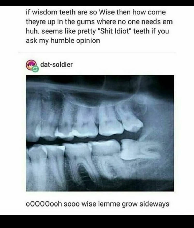 wisdom teeth x ray - if wisdom teeth are so Wise then how come theyre up in the gums where no one needs em huh. seems pretty "Shit Idiot" teeth if you ask my humble opinion datsoldier 00000ooh sooo wise lemme grow sideways
