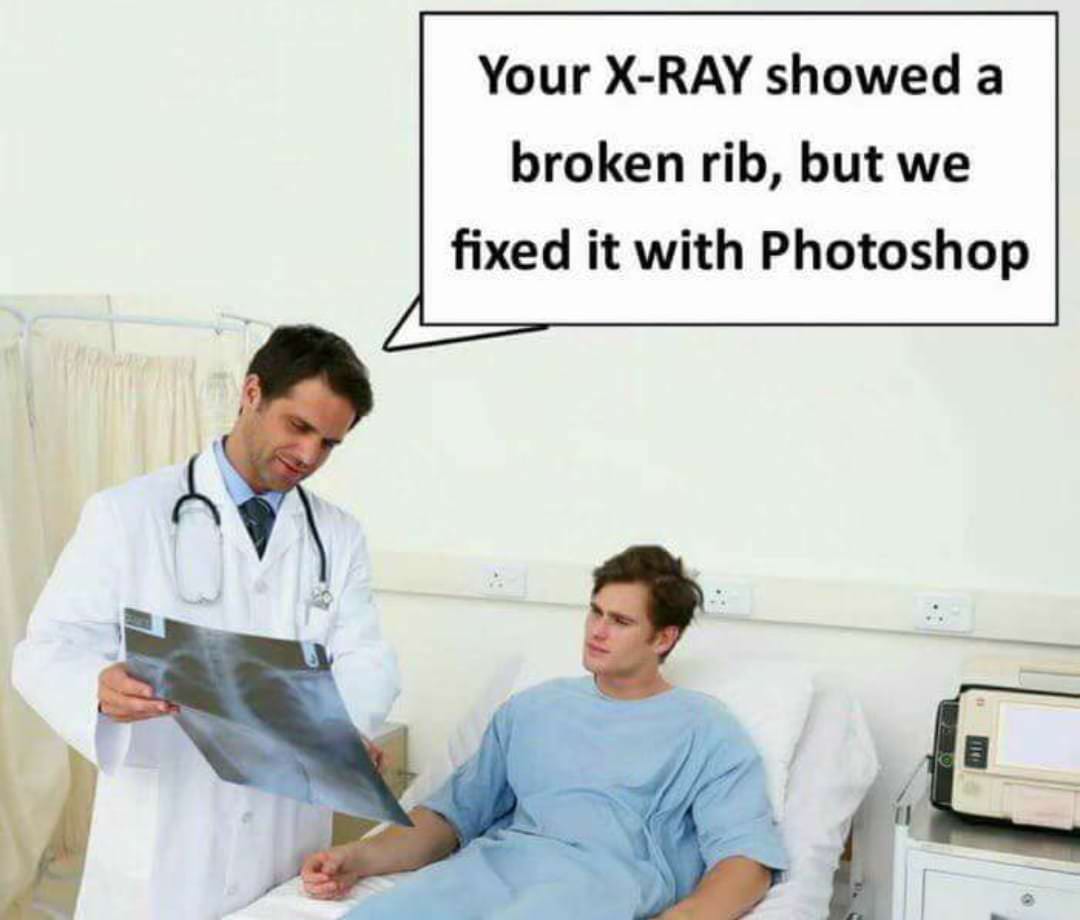 kill it with fire - Your XRay showed a broken rib, but we fixed it with Photoshop
