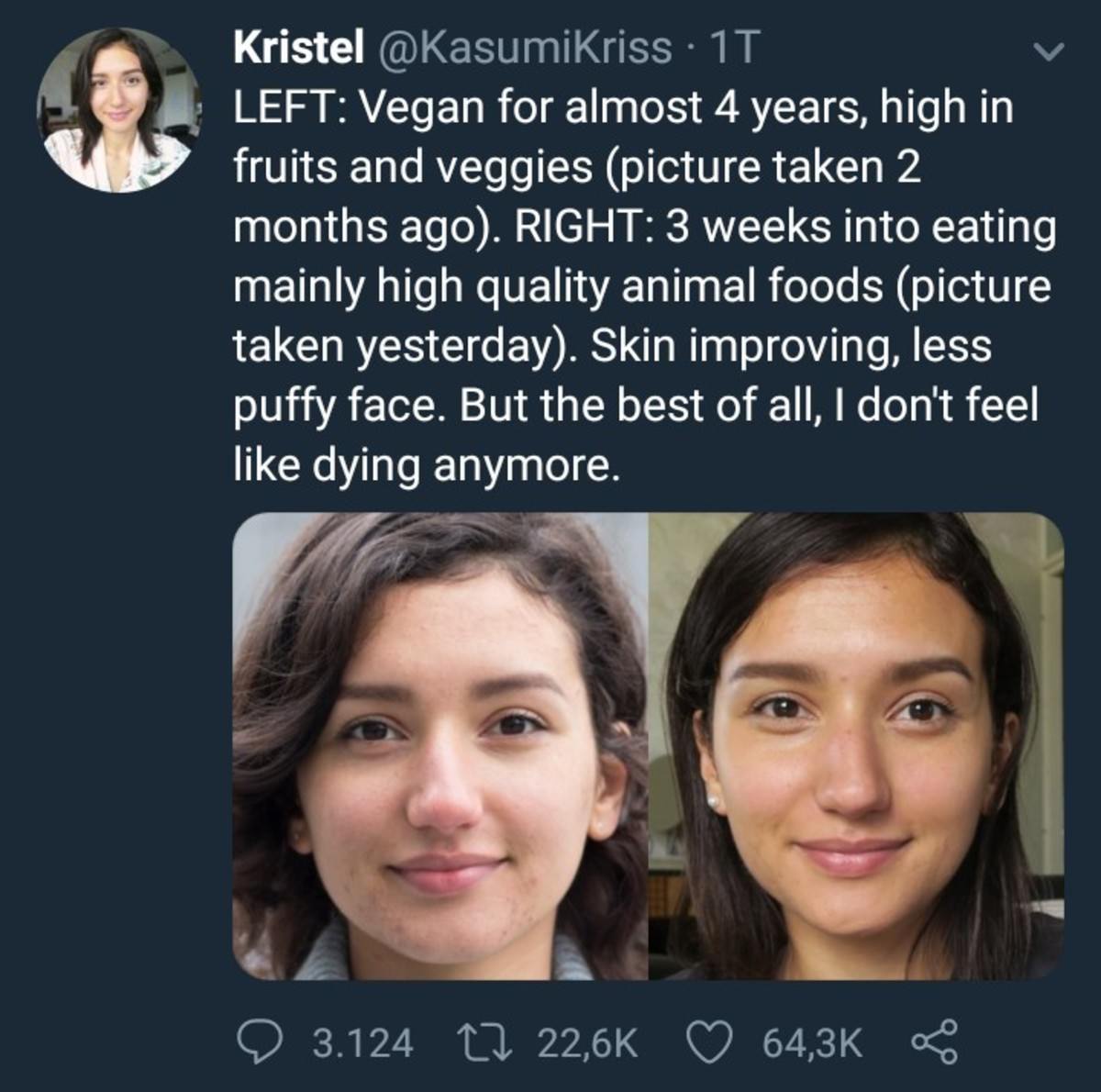 memes - vegan vs non vegan face - Kristel 17 Left Vegan for almost 4 years, high in fruits and veggies picture taken 2 months ago. Right 3 weeks into eating mainly high quality animal foods picture taken yesterday. Skin improving, less puffy face. But the