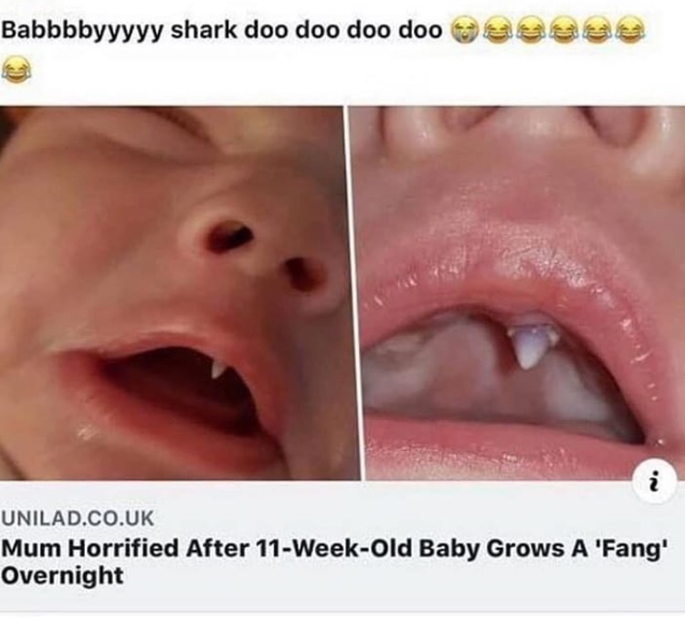 baby grows fang meme - Babbbbyyyyy shark doo doo doo doo Unilad.Co.Uk Mum Horrified After 11WeekOld Baby Grows A 'Fang' Overnight