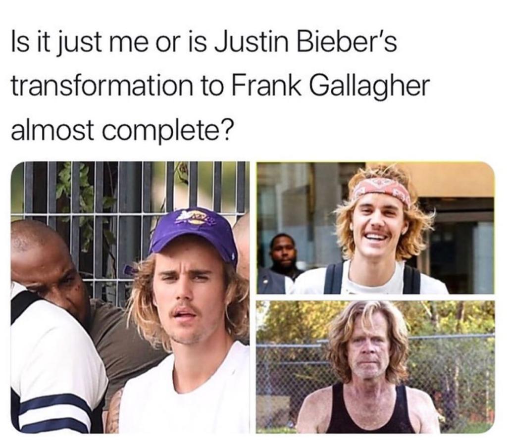 Is it just me or is Justin Bieber's transformation to Frank Gallagher almost complete?