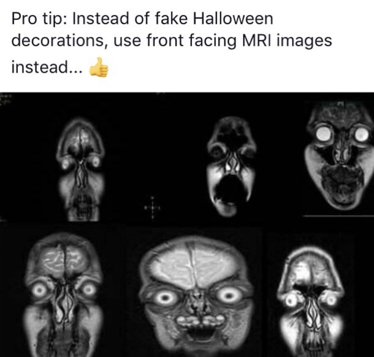 mri faces - Pro tip Instead of fake Halloween decorations, use front facing Mri images instead...
