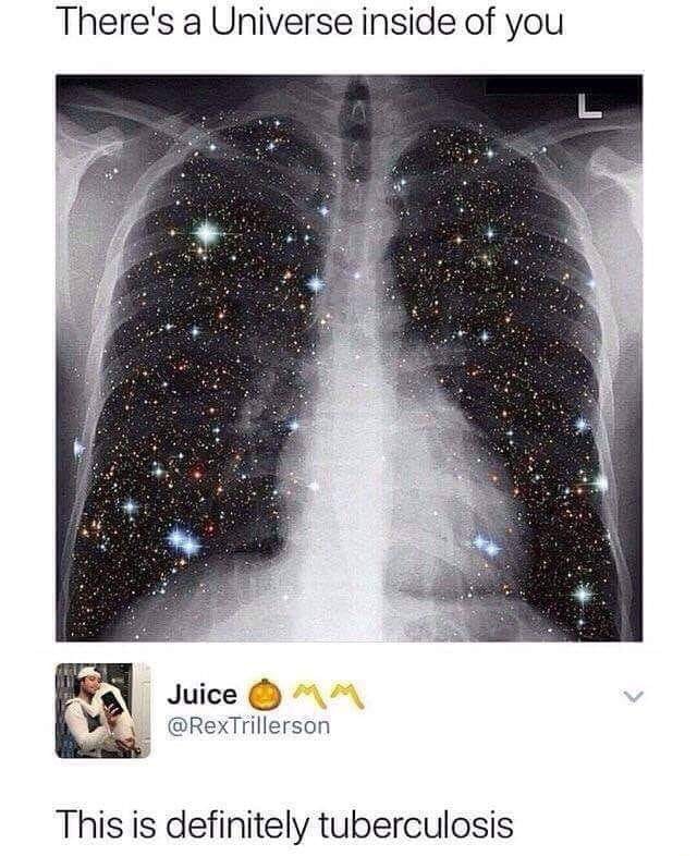 tb memes - There's a Universe inside of you Juice O Mm This is definitely tuberculosis