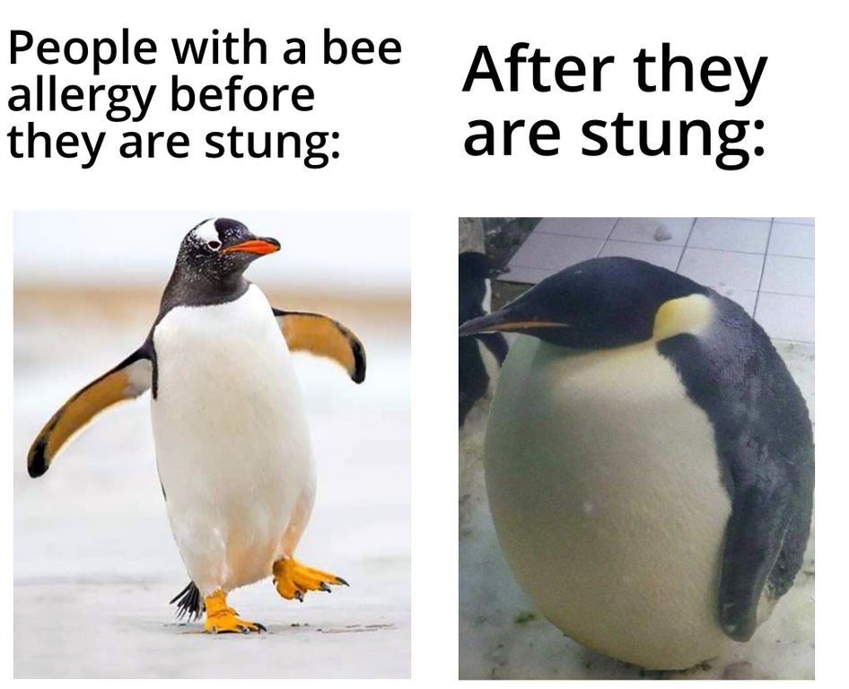 Penguins - People with a bee allergy before they are stung After they are stung